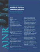 American Journal of Neuroradiology: 27 (1)