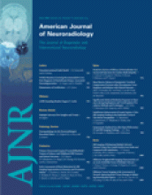 American Journal of Neuroradiology: 27 (5)