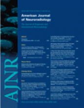 American Journal of Neuroradiology: 28 (9)