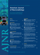 American Journal of Neuroradiology: 31 (8)