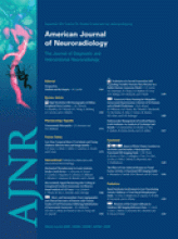 American Journal of Neuroradiology: 32 (8)