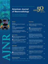 American Journal of Neuroradiology: 33 (3)