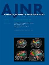 American Journal of Neuroradiology: 35 (4)