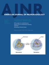 American Journal of Neuroradiology: 35 (7)