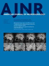 American Journal of Neuroradiology: 38 (8)