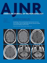 American Journal of Neuroradiology: 39 (4)