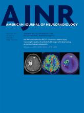 American Journal of Neuroradiology: 40 (2)