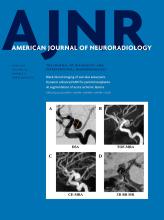 American Journal of Neuroradiology: 40 (6)