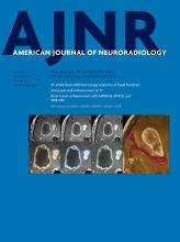 American Journal of Neuroradiology: 40 (7)