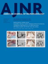American Journal of Neuroradiology: 42 (11)